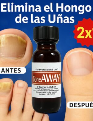 🔥 ¡Tratamiento Anti-hongos para Uñas! Fórmula de Máxima Potencia APROVECHA LA OFERTA 2X1 (⚡ Oferta Disponible Solo por Pocas Horas)