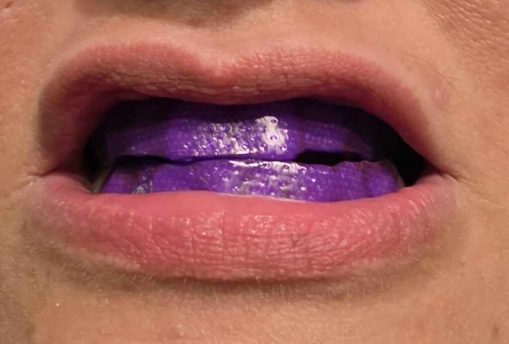 Image #1 from Elena Mena