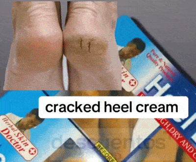 Heel Balm aplicación en talones resecos